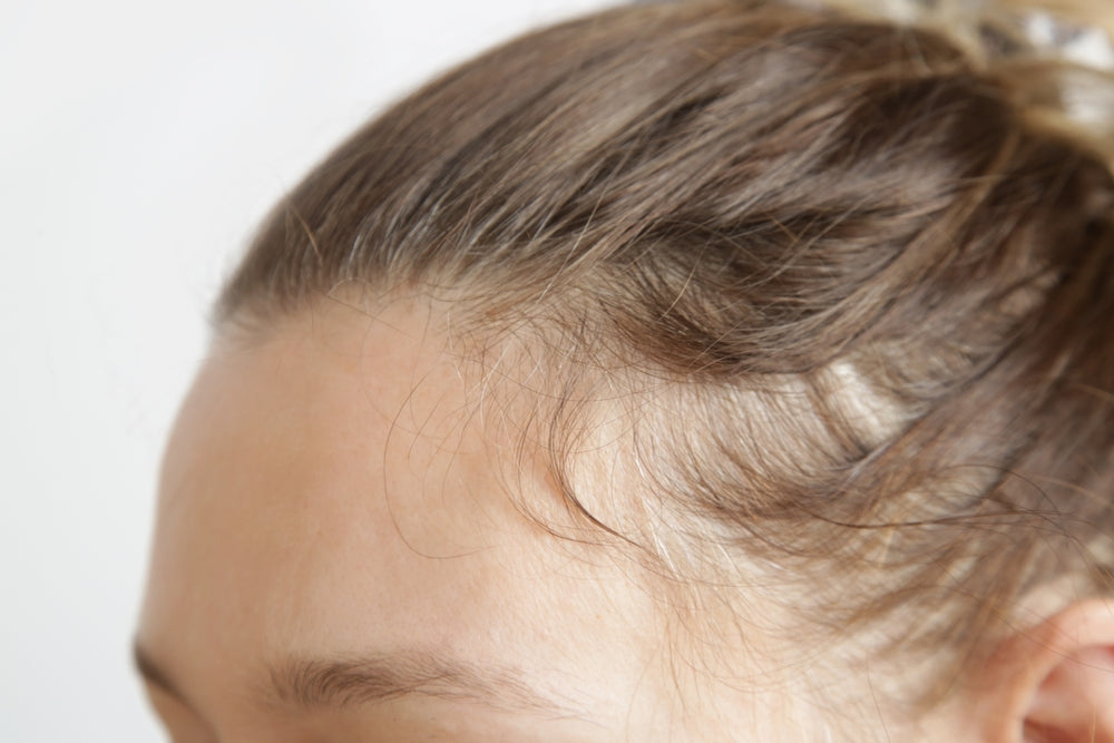 Experiencing Hair Loss? Here's What You Can Do — and How Compounding Can Help